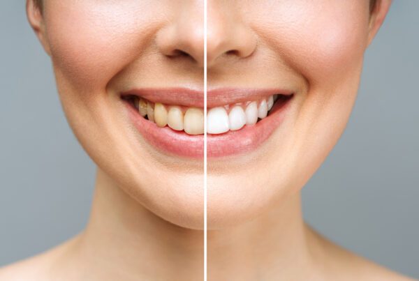 Tips For A Brighter Smile