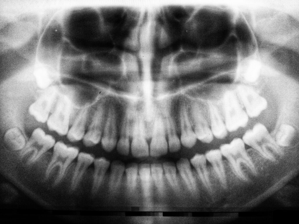 Central Hutt Dental: Offering High Quality Dental Services at an Affordable Price